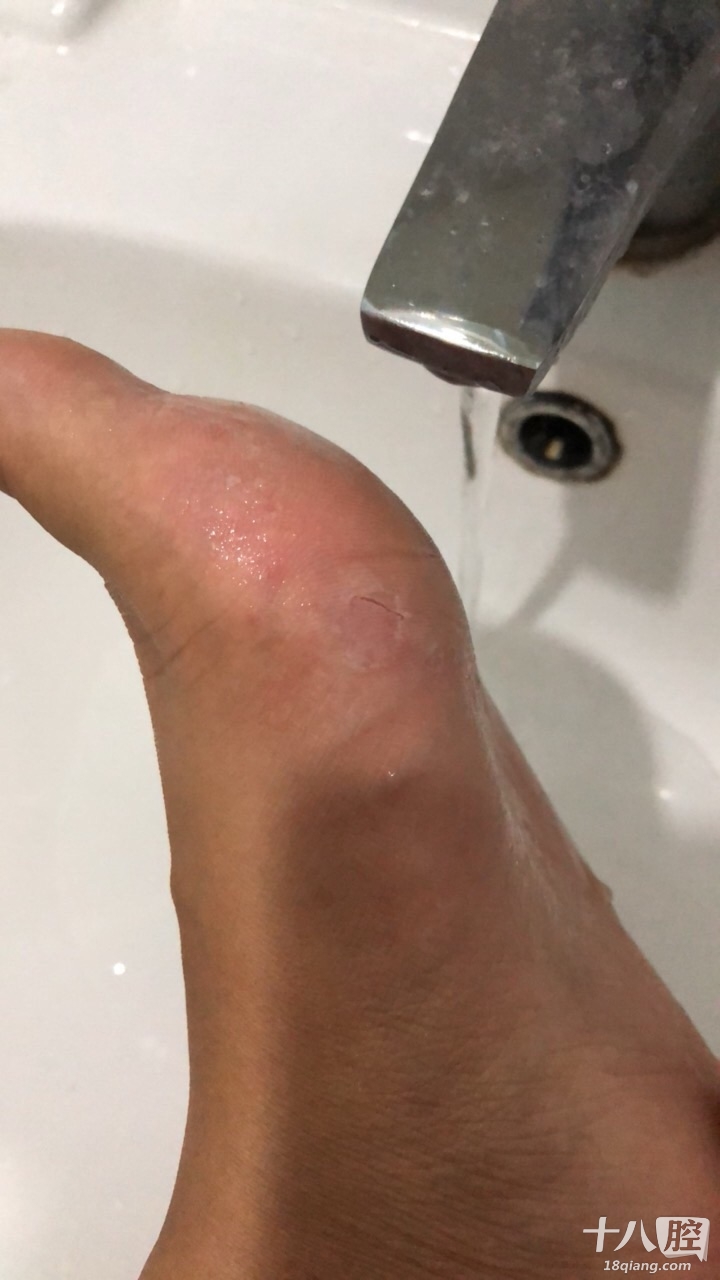 义乌哪里可以打狂犬疫苗。刚刚被家里的小狗的