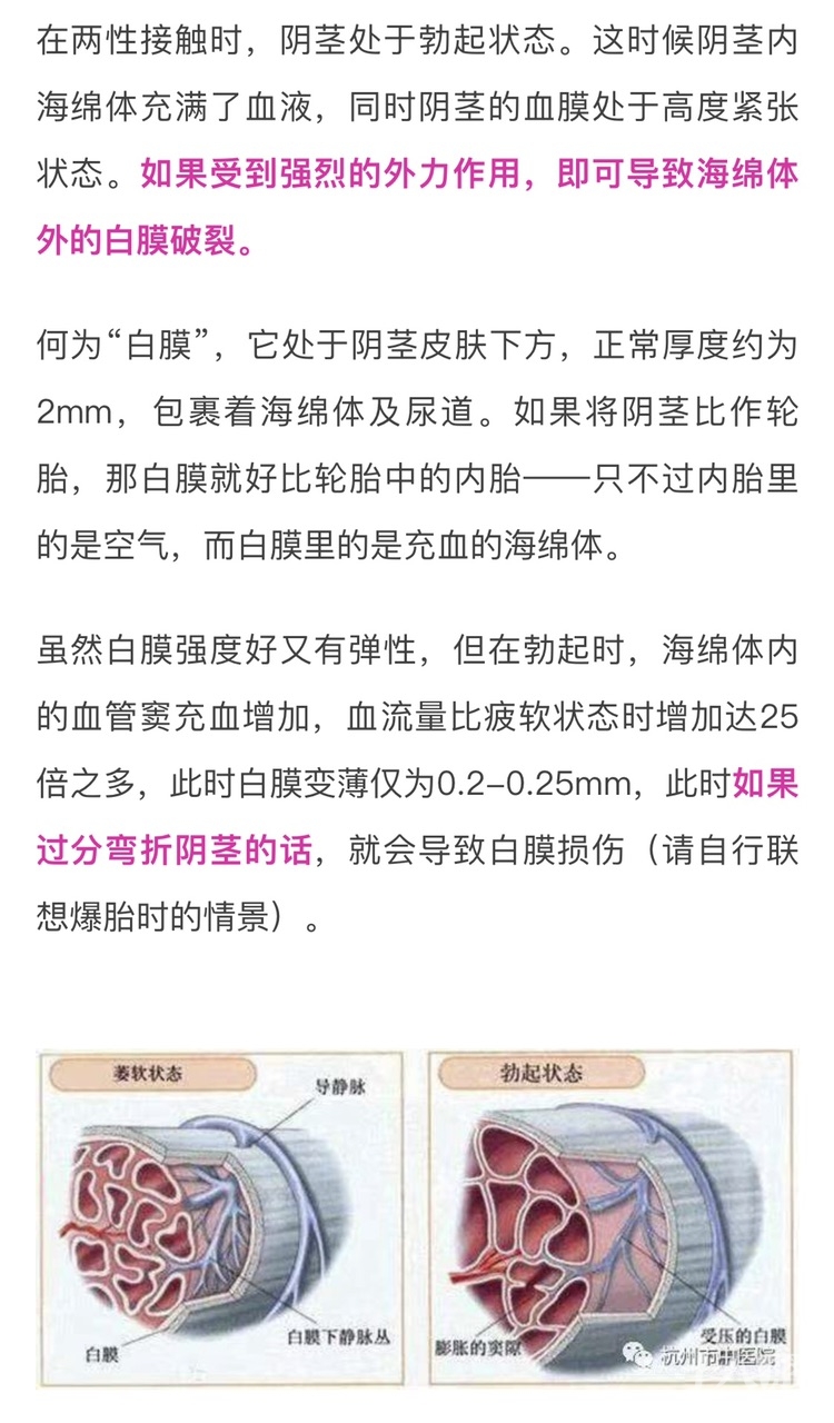 尴尬一对夫妻清晨正恩爱啪一声断了